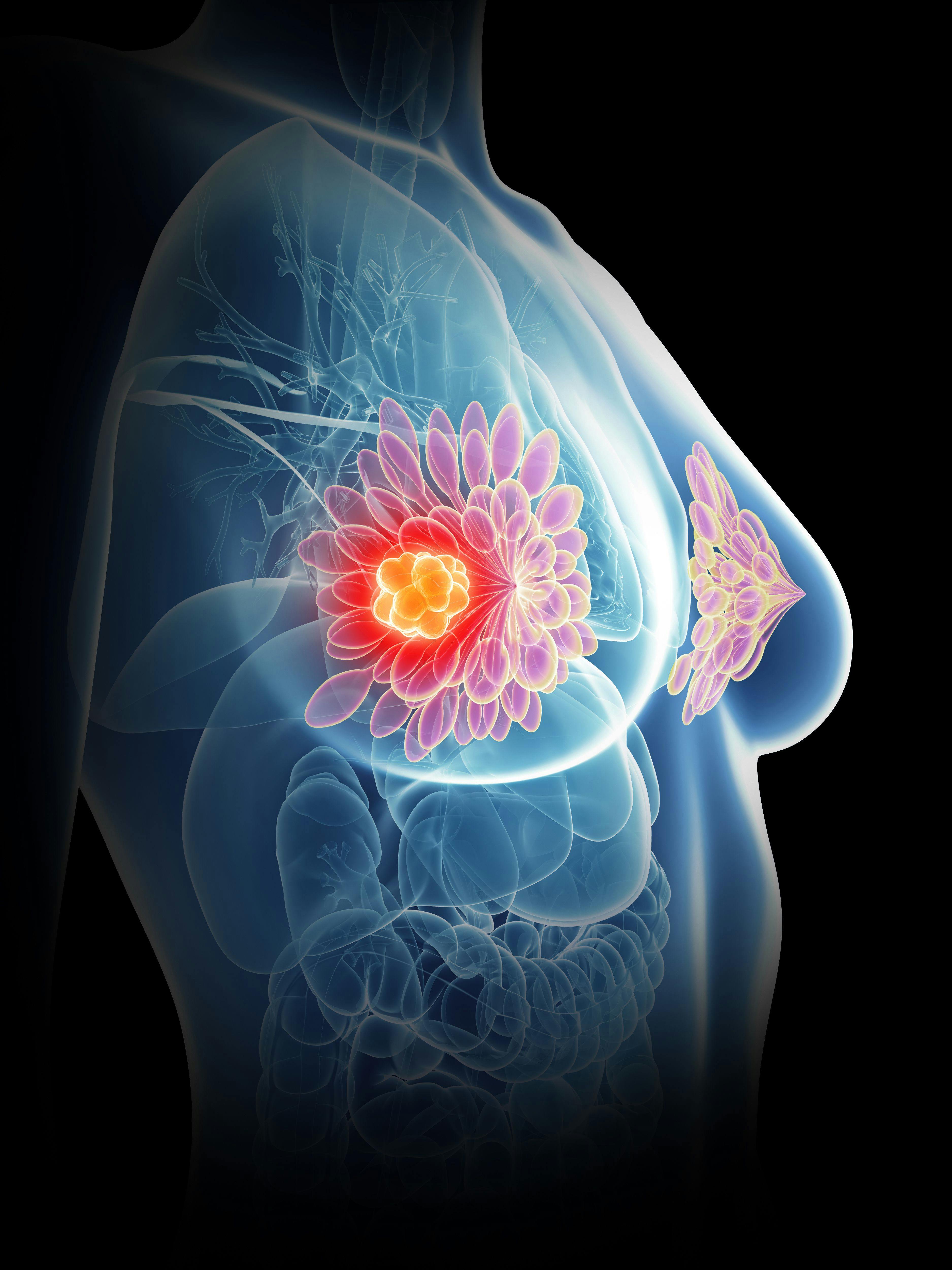 3d image of breast | Image credit: © SciePro stock.adobe.com 