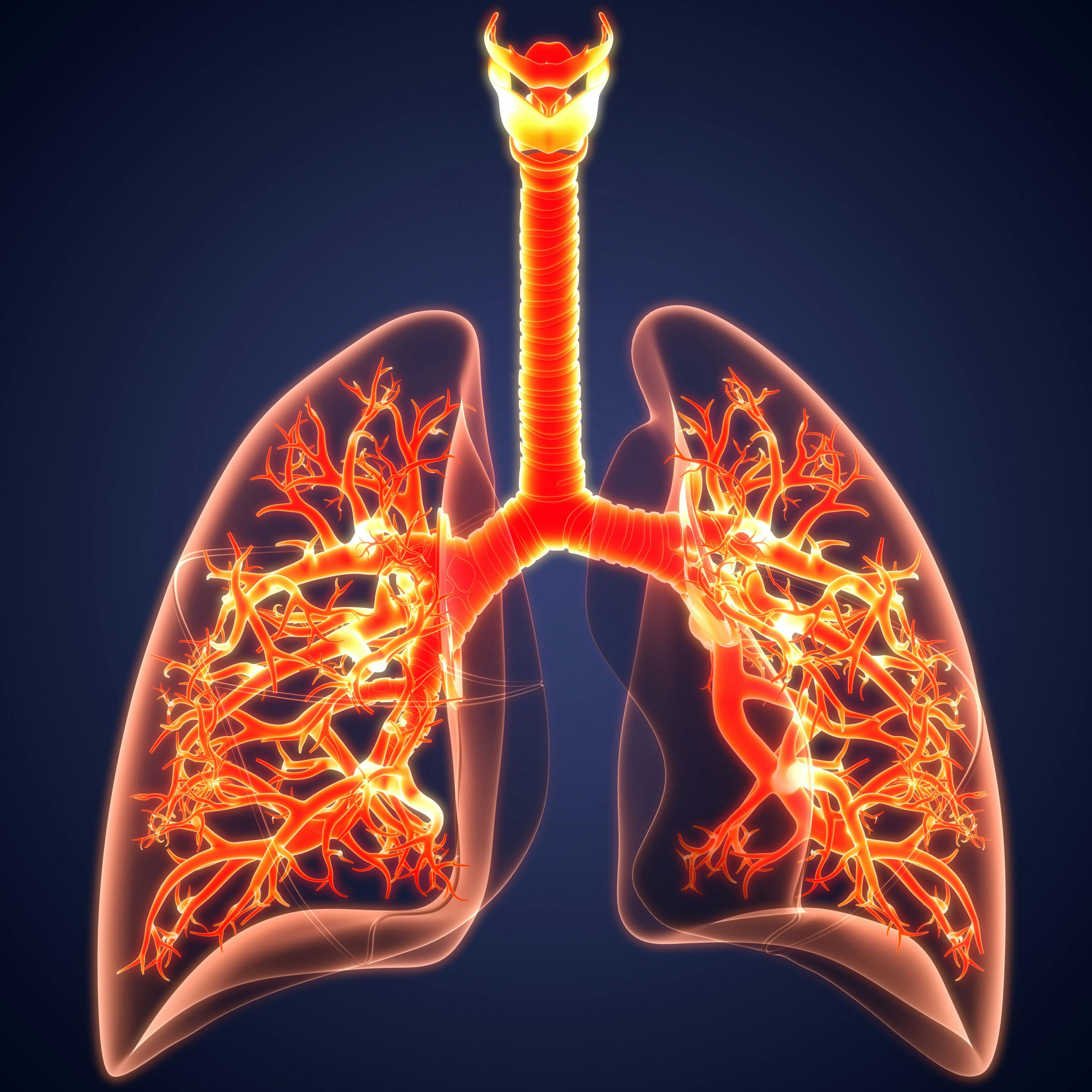 A Surge of Biologics for Severe Asthma