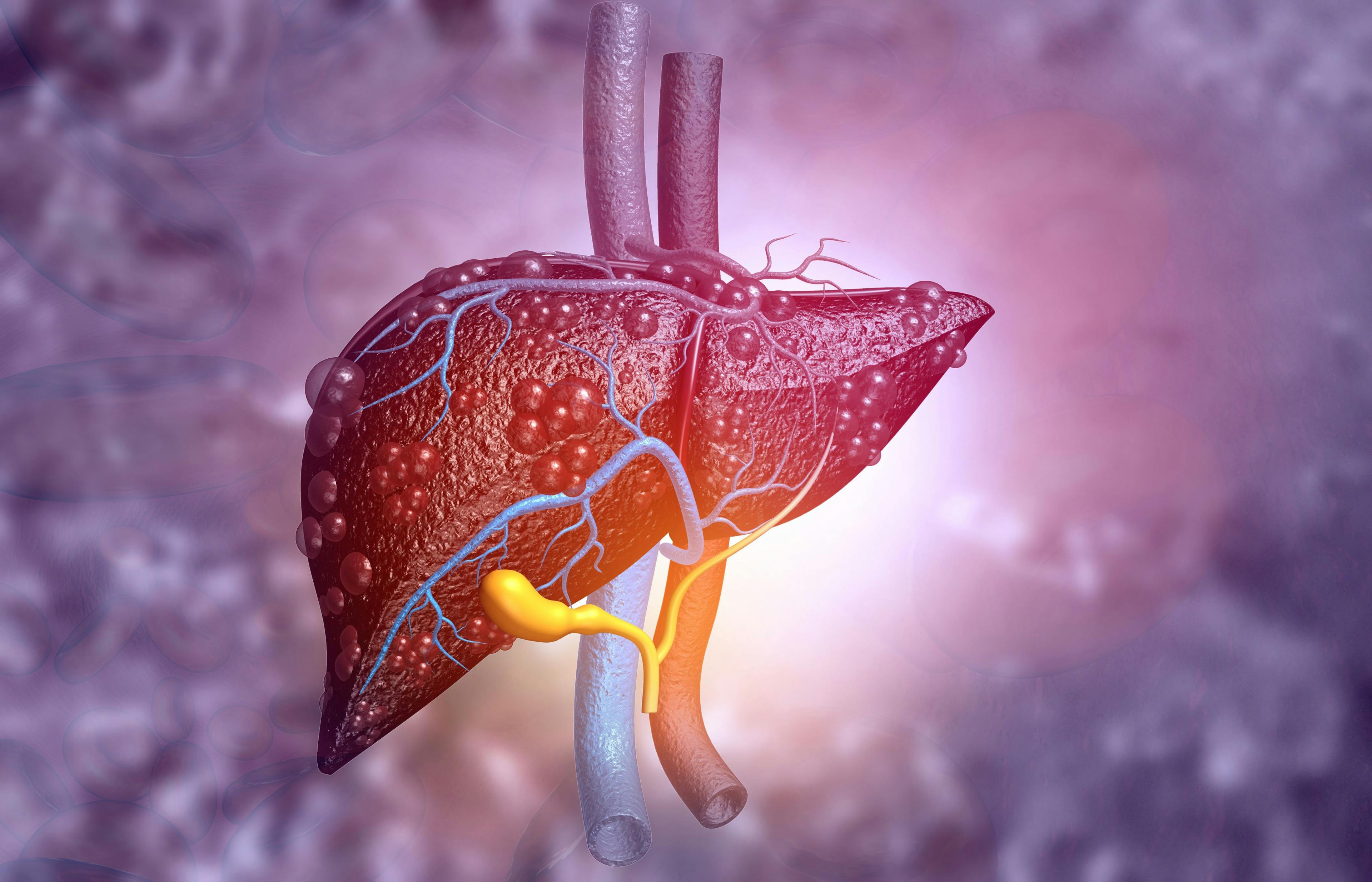 Alcohol’s Role in Liver Disease Deaths During COVID-19