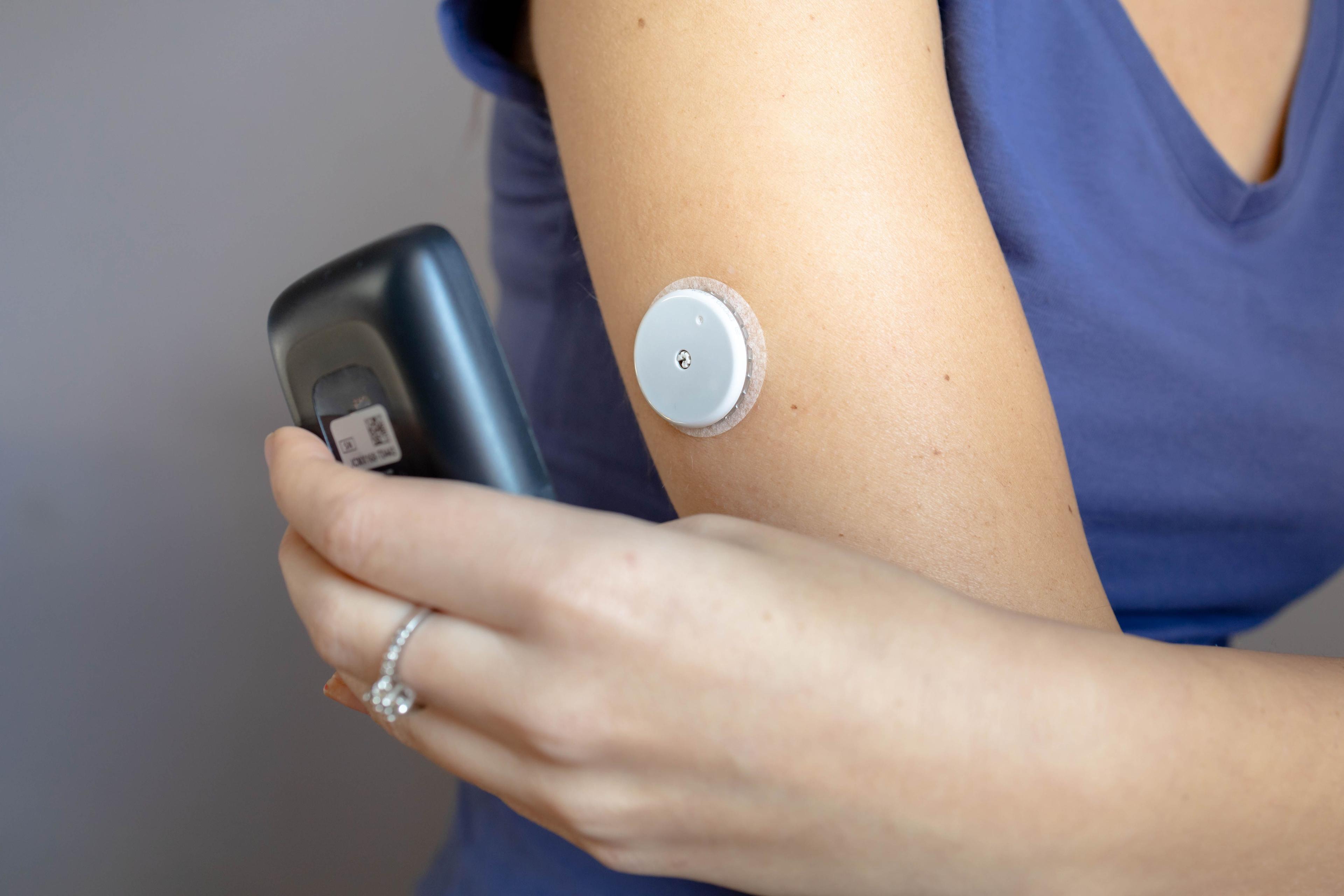 female hand and continuous glucose monitor | Image credit: ©stivog stock.adobe.com