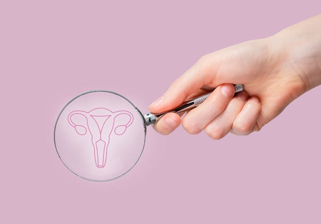 Ovary Removal Before Menopause is Linked to Cognitive Health Decline